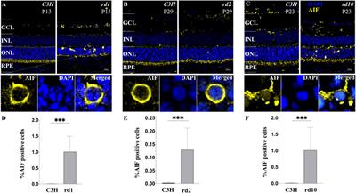 RNA Biological Characteristics at the Peak of Cell Death in Different Hereditary Retinal Degeneration Mutants